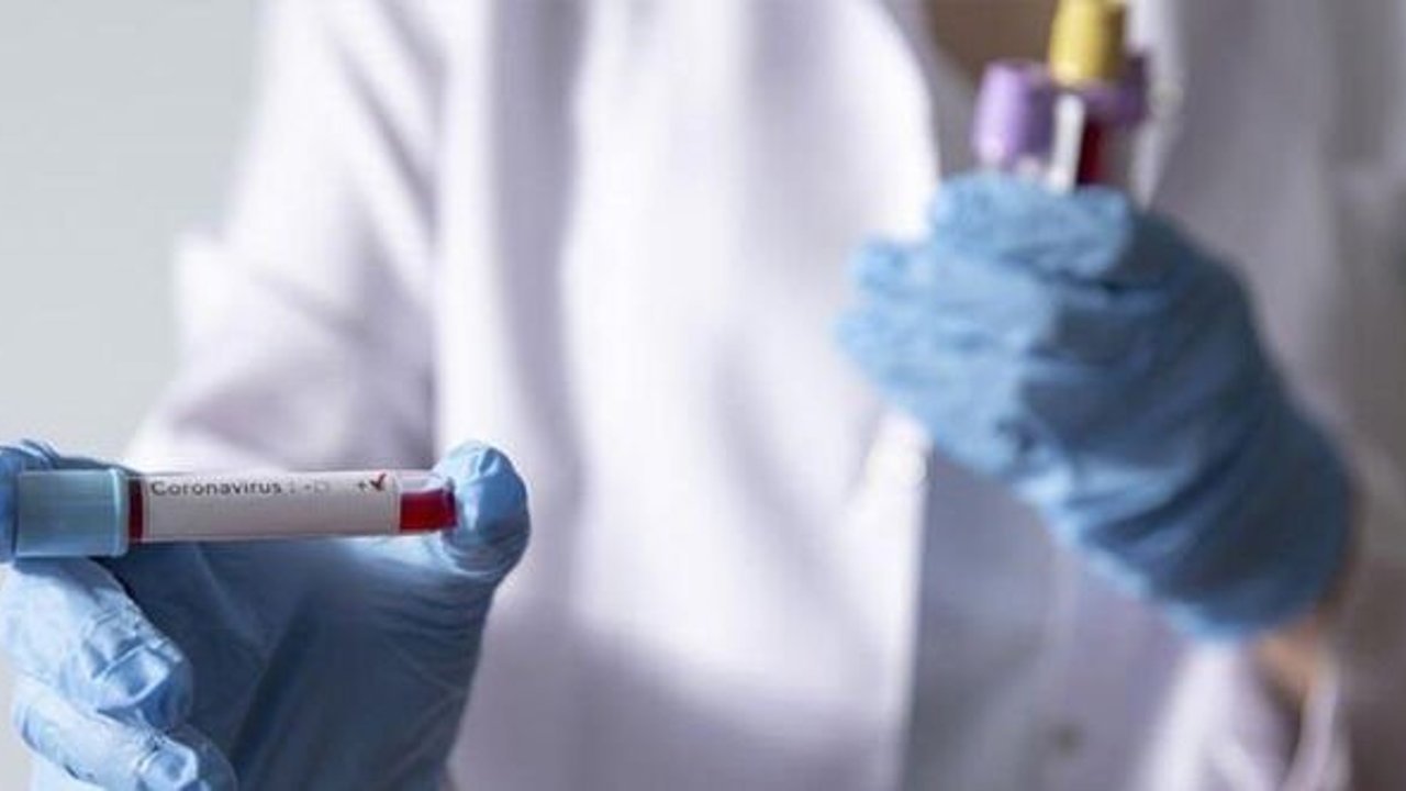 Eskişehir'de yaşayan ailenin testi pozitif çıktı