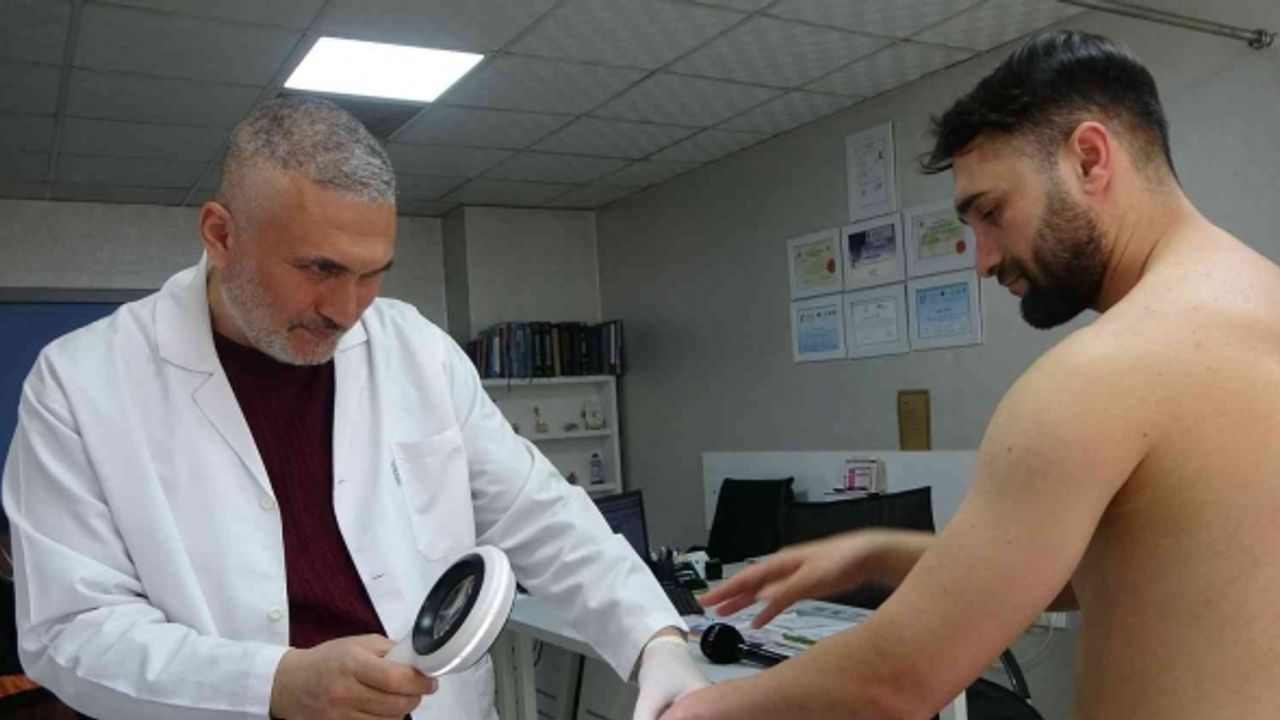 Uzmanlardan uyarı: “Uyuz, 15-20 yılda bir tüm dünyada salgın halinde gözükebilir”