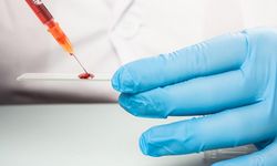 Sadece 50 kişide var: Bir damlası bile servet değerinde