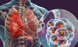 İl Sağlık Müdürü Bildirici'den hayati uyarı! Belirtileri grip sanılabiliyor