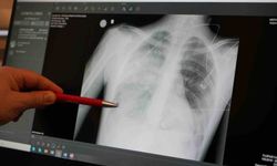 Eskişehir'e kış geldi: Çocuklarınızı zatürreden korumak için bunlara dikkat edin