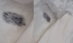 Eskişehir'de skandal iddia: Bebek bezinden çıktı...