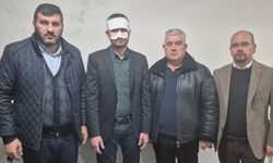 Eskişehir'de okulda korkunç olay! Sıcak çayı yüzüne döktü