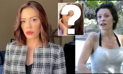 Survivor'ın eski yarışmacısı yüz nakli oldu