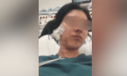 Eskişehir'de eski sevgilisi tarafından darp edilmişti: "Kulağını ısırarak koparmaya çalıştı"