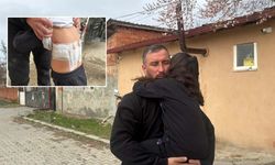 Küçük kız bahçede oynarken kabusu yaşadı: Hastanede tedavi altına alındı