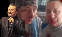 Et yiyen bakteri kapmıştı! Ölümden döndü: Pitbull saldırısında yeni gelişme!