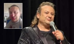 Sanatçı Onur Akay kanlar içinde kaldı! Saldırıya uğradılar