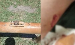 Eskişehir'de bakımsız park bir çocuğu hastanelik etti: 9 dikiş atıldı