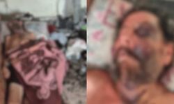 İnsanlığın geldiği nokta! Ölüme terk ettiler