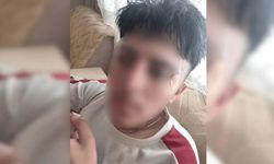 Öğretmeni suratına kafa attı: Çıraklık eğitimi gören çocuğun burnu kırıldı