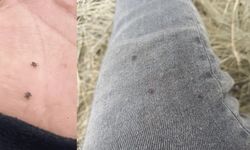 Eskişehir'de mahalle sakinleri tedirgin: Çok sayıda kene var