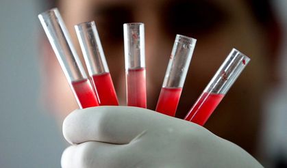 Anne babalar dikkat: İşte en zeki çocukların kan grubu