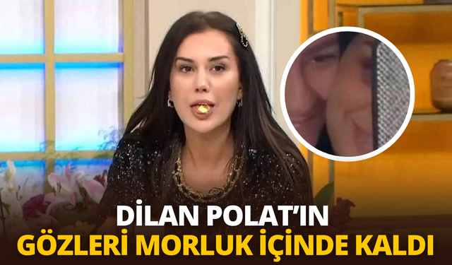 Dilan Polat'ın gözleri morluk içinde kaldı: Sakladığı morlukları ortaya çıktı