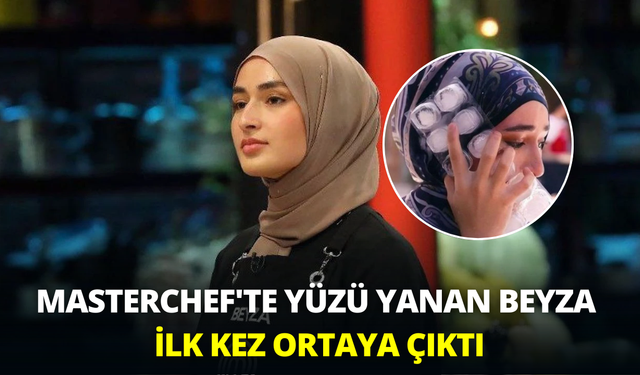 MasterChef'te yüzü yanan Beyza ilk kez ortaya çıktı: Gözyaşları sel oldu