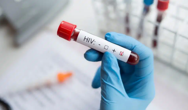 İl Sağlık Müdürlüğü'nden AIDS bilgilendirmesi