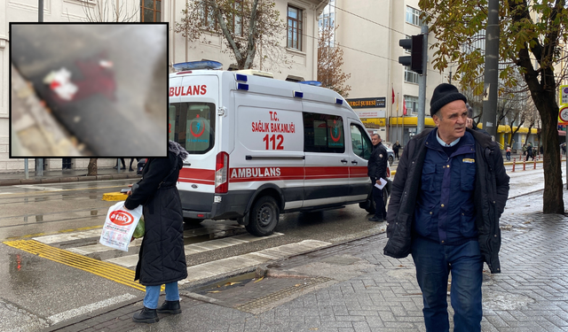 Eskişehir'de yolun karşısına geçmek isterken canından oluyordu!