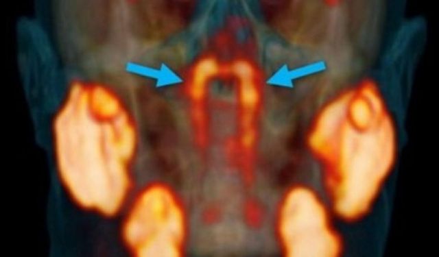 Bilim insanları insan vücudunda yeni organ buldu!