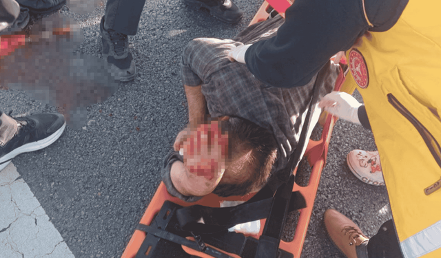 Komşuda motosiklet sürücüsü köpeğe çarpmamak için manevra yapınca bariyerlere çarptı