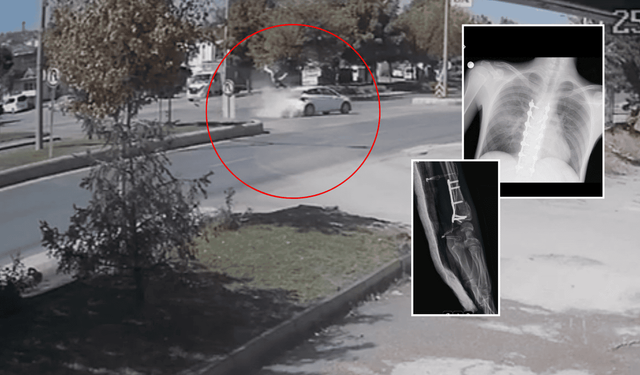 Eskişehir'deki kazada ağır yaralanmıştı: 20 yaşındaki Yusuf'un babası konuştu