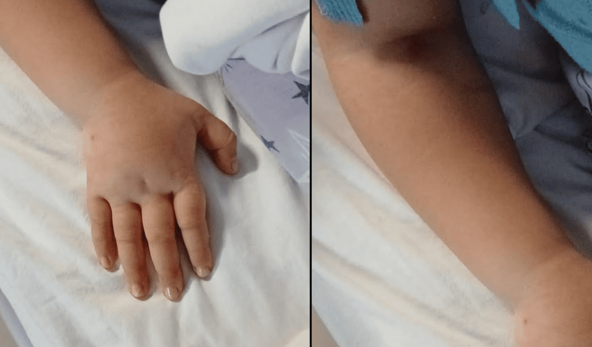 Eskişehir'de hemşire ihmali iddiası: 5 yaşındaki çocuğun ailesi şikayetçi!