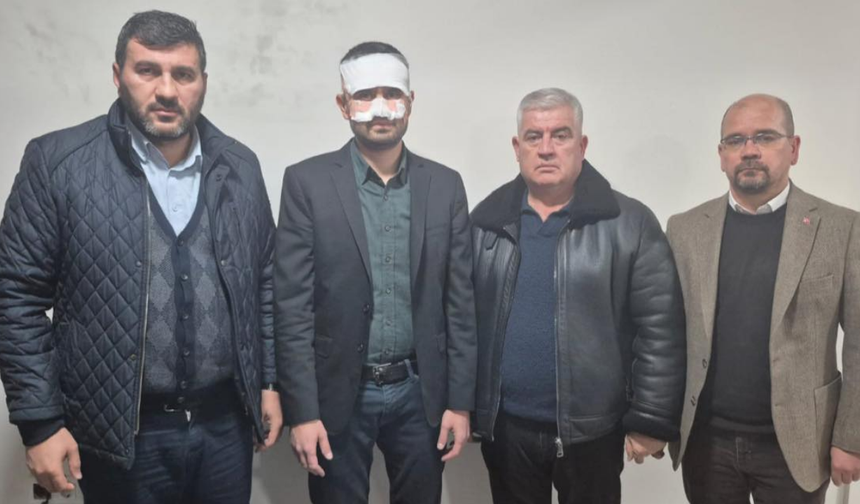 Eskişehir'de okulda korkunç olay! Sıcak çayı yüzüne döktü