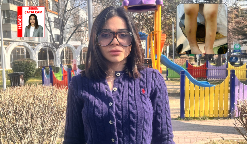 Eskişehir’de kreşte darp iddiası