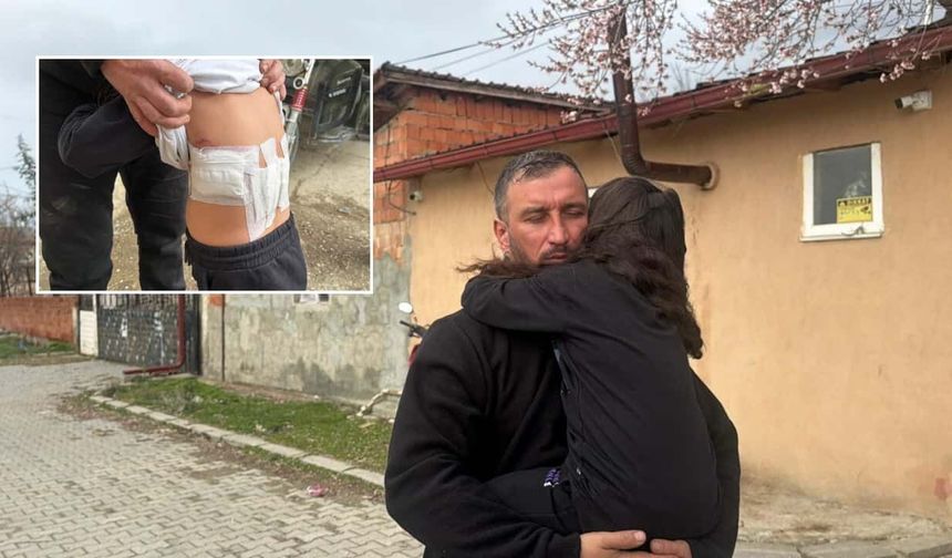 Küçük kız bahçede oynarken kabusu yaşadı: Hastanede tedavi altına alındı