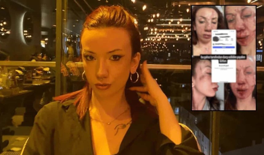 Eskişehir'de gazetecilik öğrencisi genç kıza darp iddiası