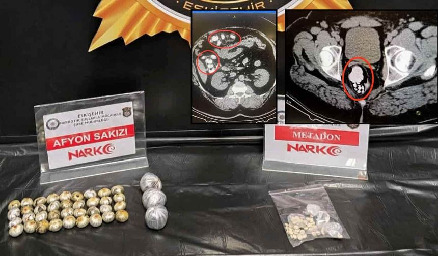 Mide değil, uyuşturucu kapsülü! Eskişehir'de binlerce kişiyi zehirleyecekti: Tam 40 parça uyuşturucu midesinden çıktı