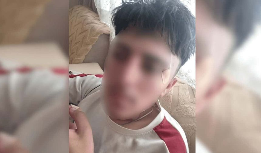 Öğretmeni suratına kafa attı: Çıraklık eğitimi gören çocuğun burnu kırıldı
