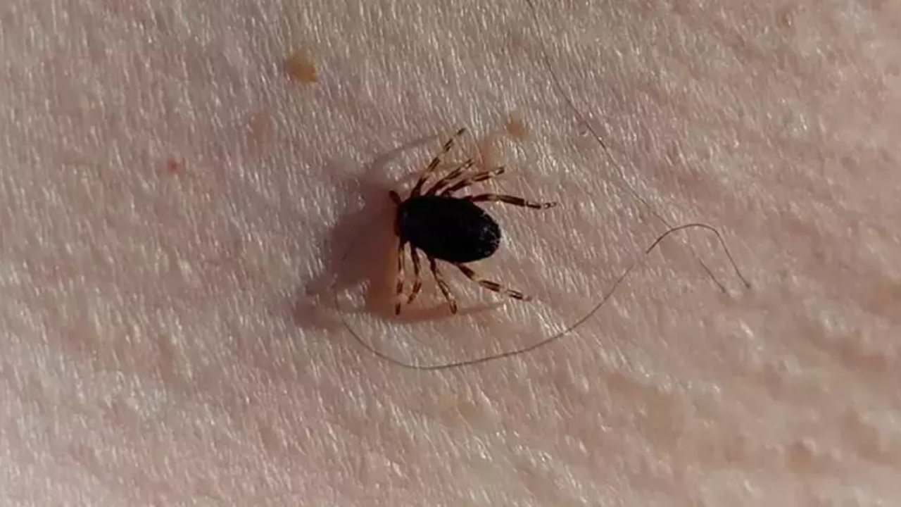 Sağlık Bakanlığı'ndan Kritik Kene Açıklaması! Türkiye'de Kene Yoğunluğu...