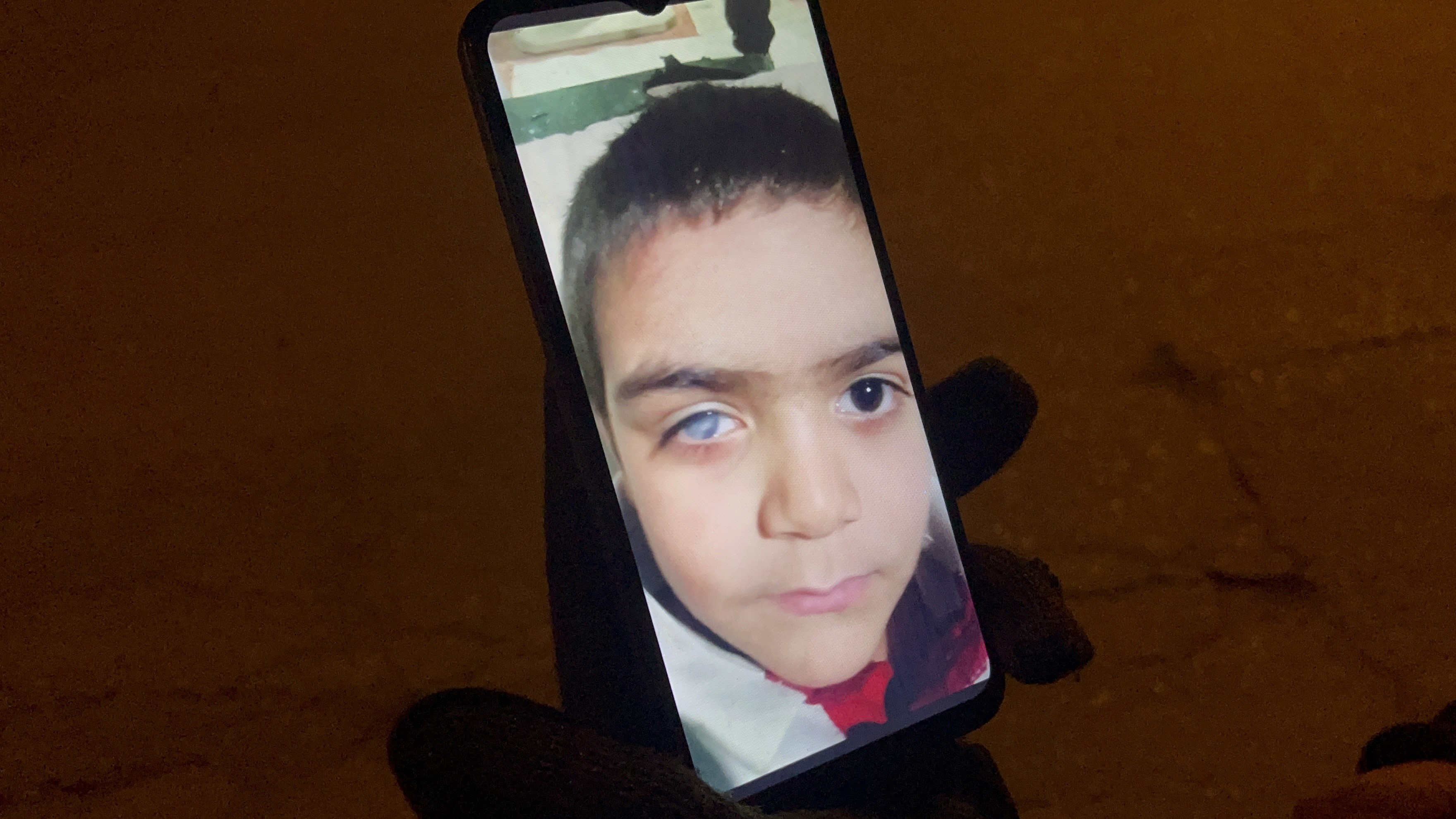 Eskişehir'de 45 Yaşındaki Kadın Hayat Mücadelesi Veriyor (1)