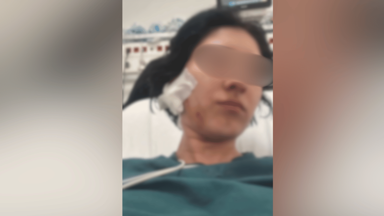 Eskişehir'de Kadına Şiddet Iddiası Ağzımdan Köpükler Gelene Kadar Darp Etti