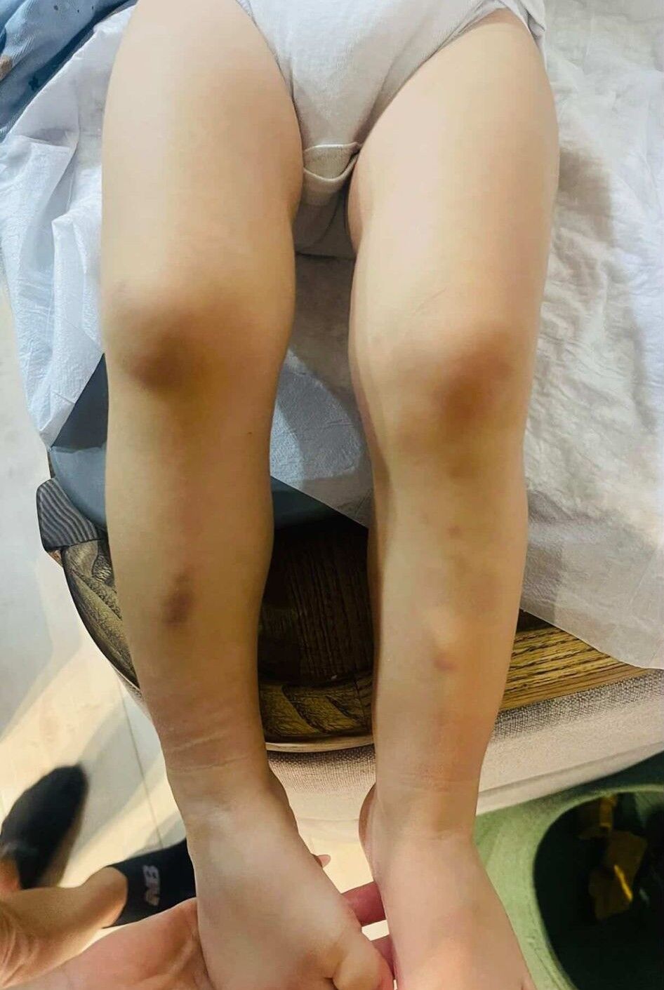 Kreşte Darp Iddiası 4