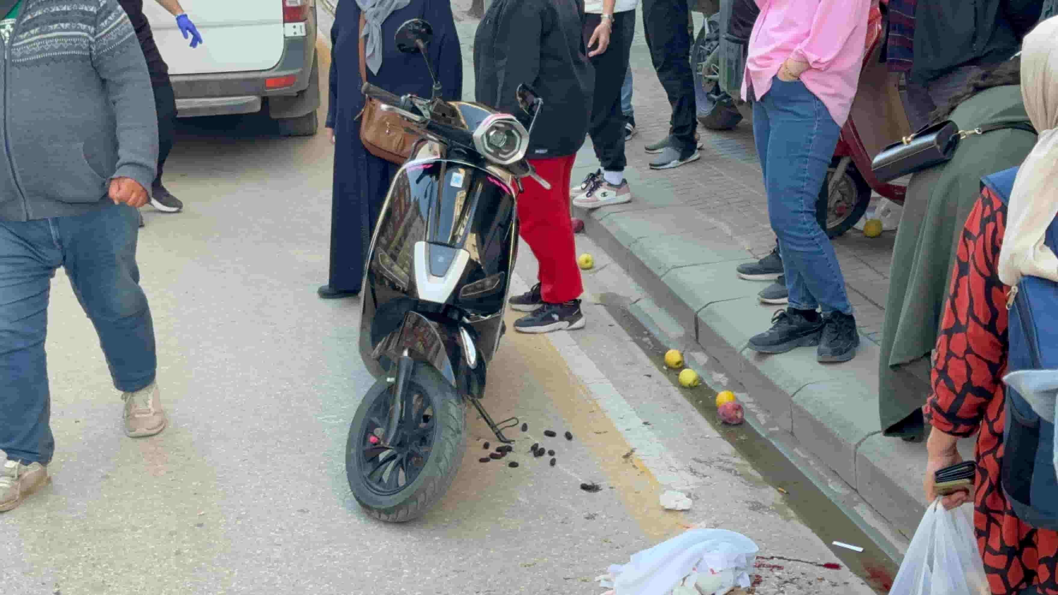 Scooterin çarptığı yaya yaralandı