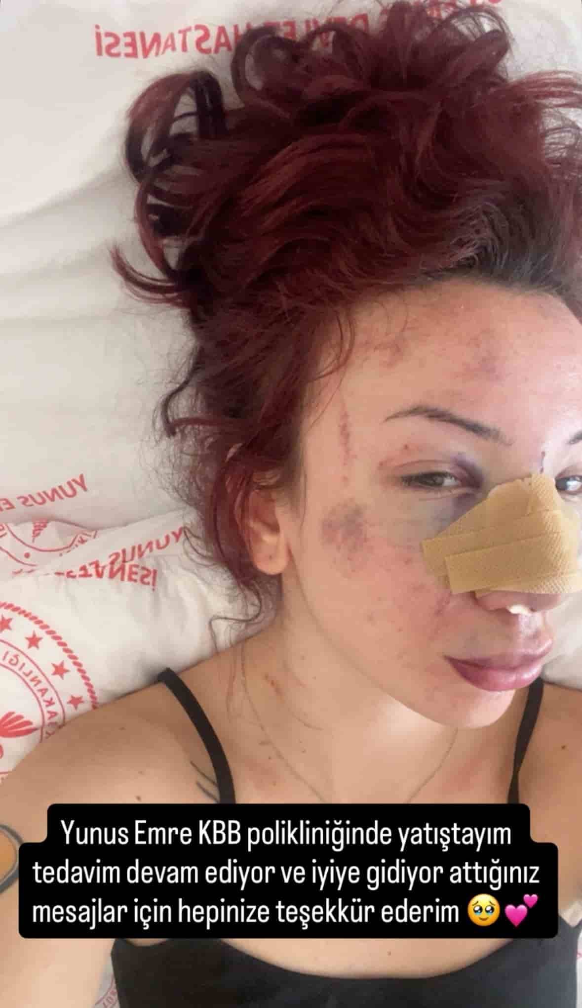 Darp Edilen Üniversite Öğrencisi Açıklama