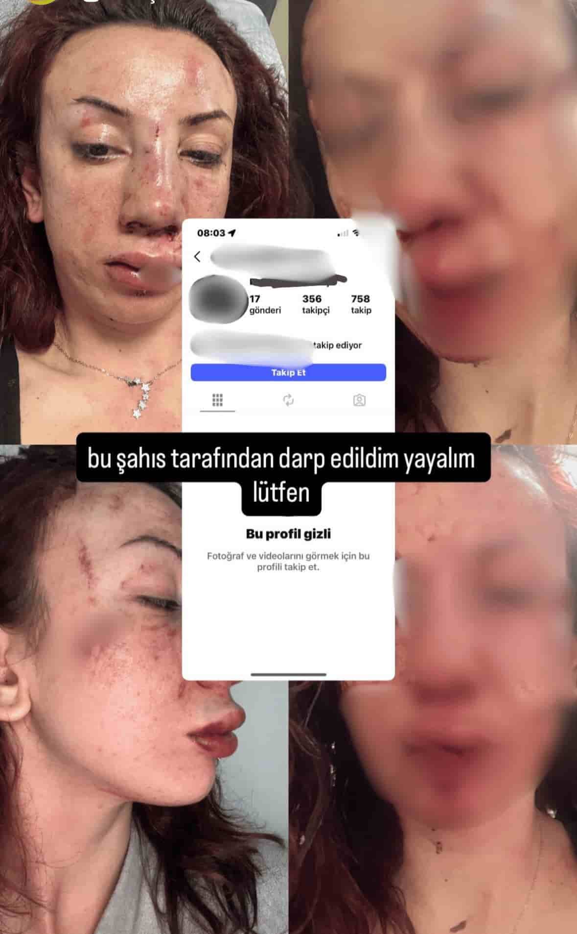 Darp Edilen Üniversite Öğrencisi
