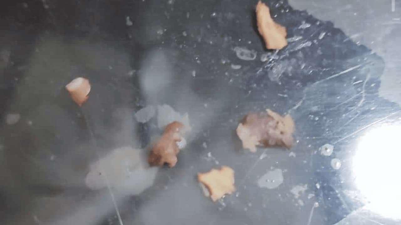 Eskişehir'de Mide Bulandıran Iddia Ciddi Şekilde Endişelendik