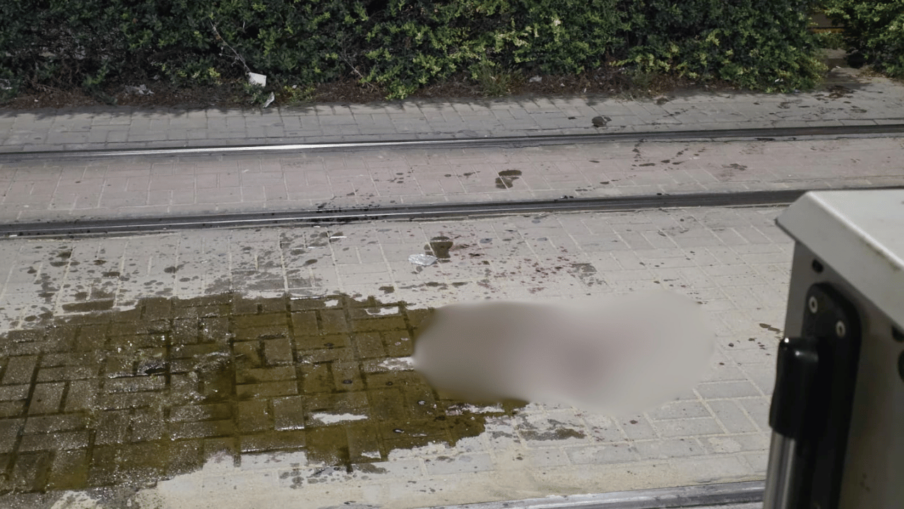 Eskişehir’de Gençlerin Tartışması Kanlı Bitti Bir Kişi Boğazından Yaralandı!